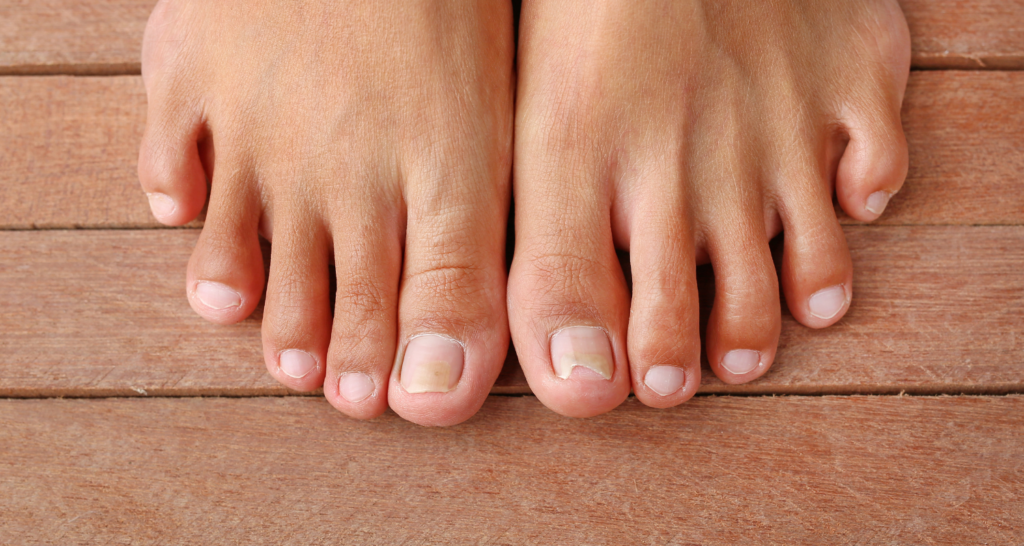 Caring for toenails discount